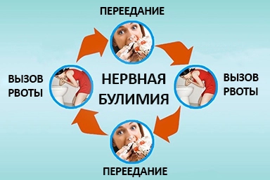 Лечение булимии в Таврическом